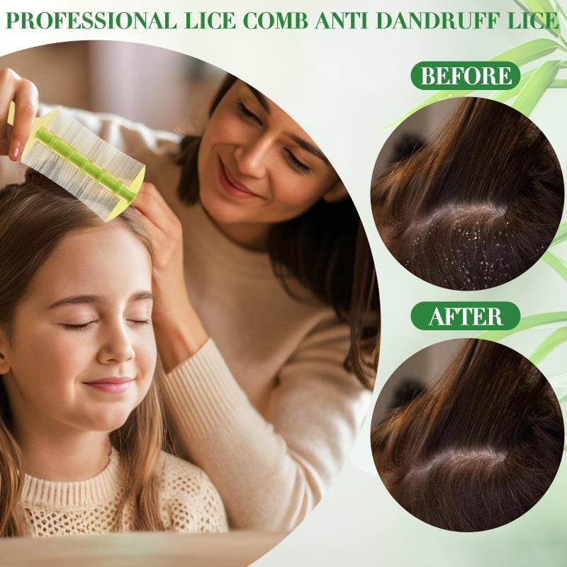 START MAKERS 3PCS Dandruff Comb Set - Extra Fine Tooth Combs for Women, Men, Kids - Removes Lice and Conditions Hair Care Grooming - Image 3